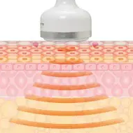 キャビテーションの仕組み