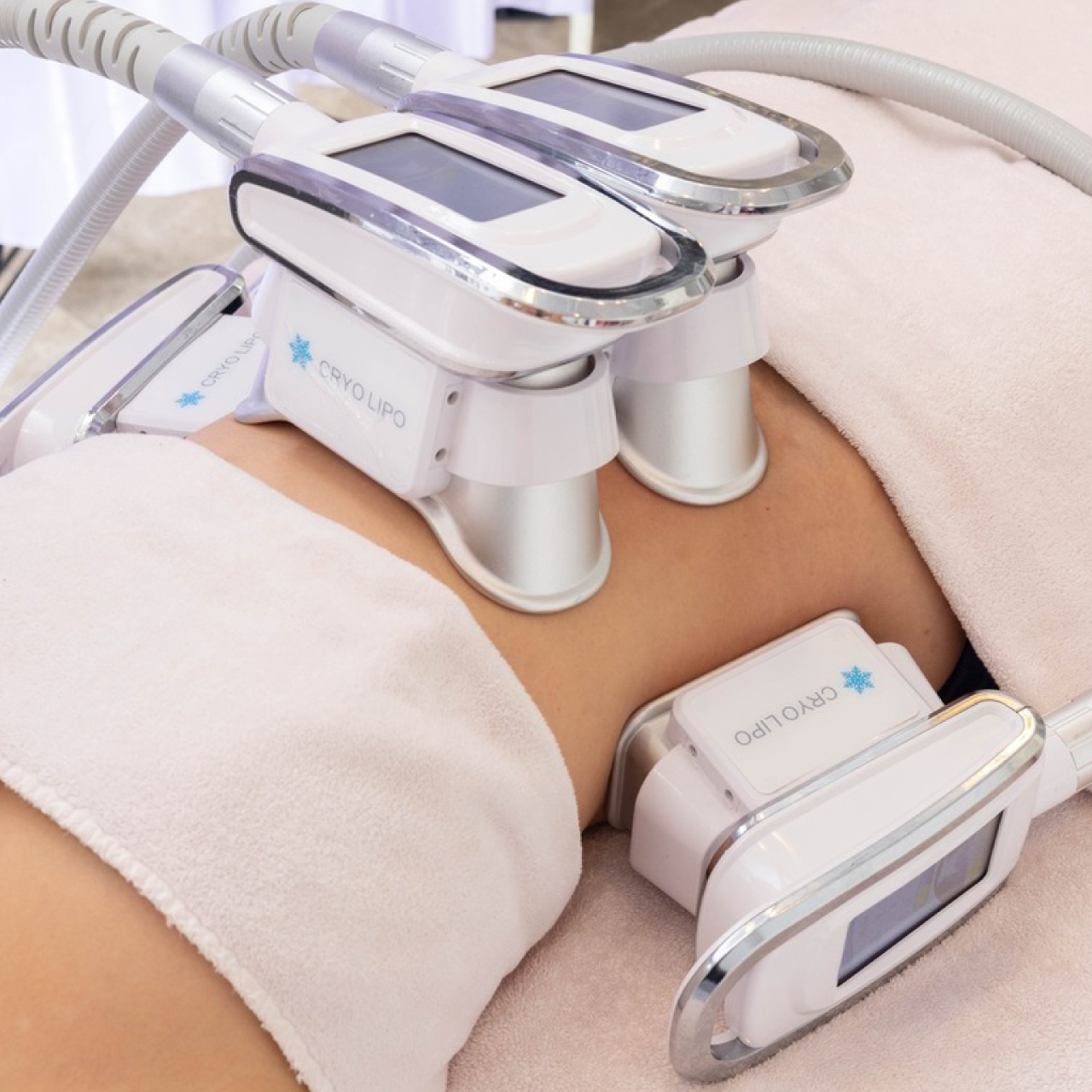 脂肪冷却 施術マシン