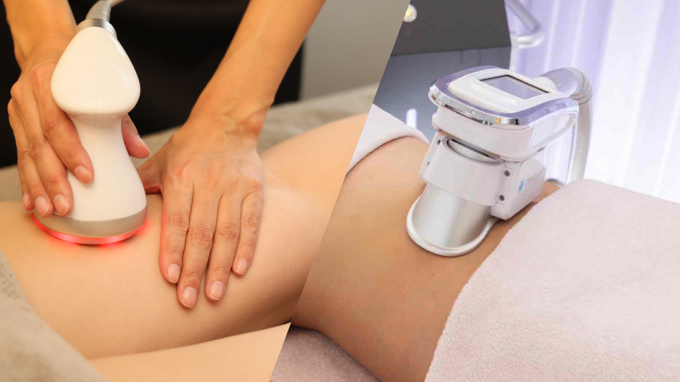 脂肪冷却＋部分痩身コース施術写真